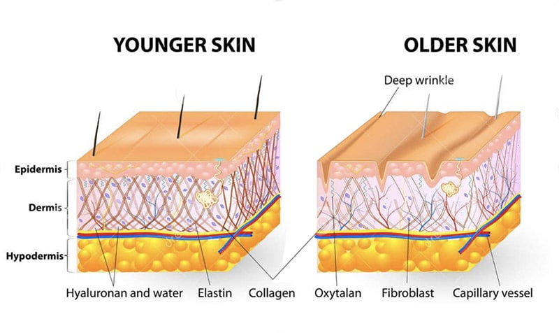 Tightening Older Skin 