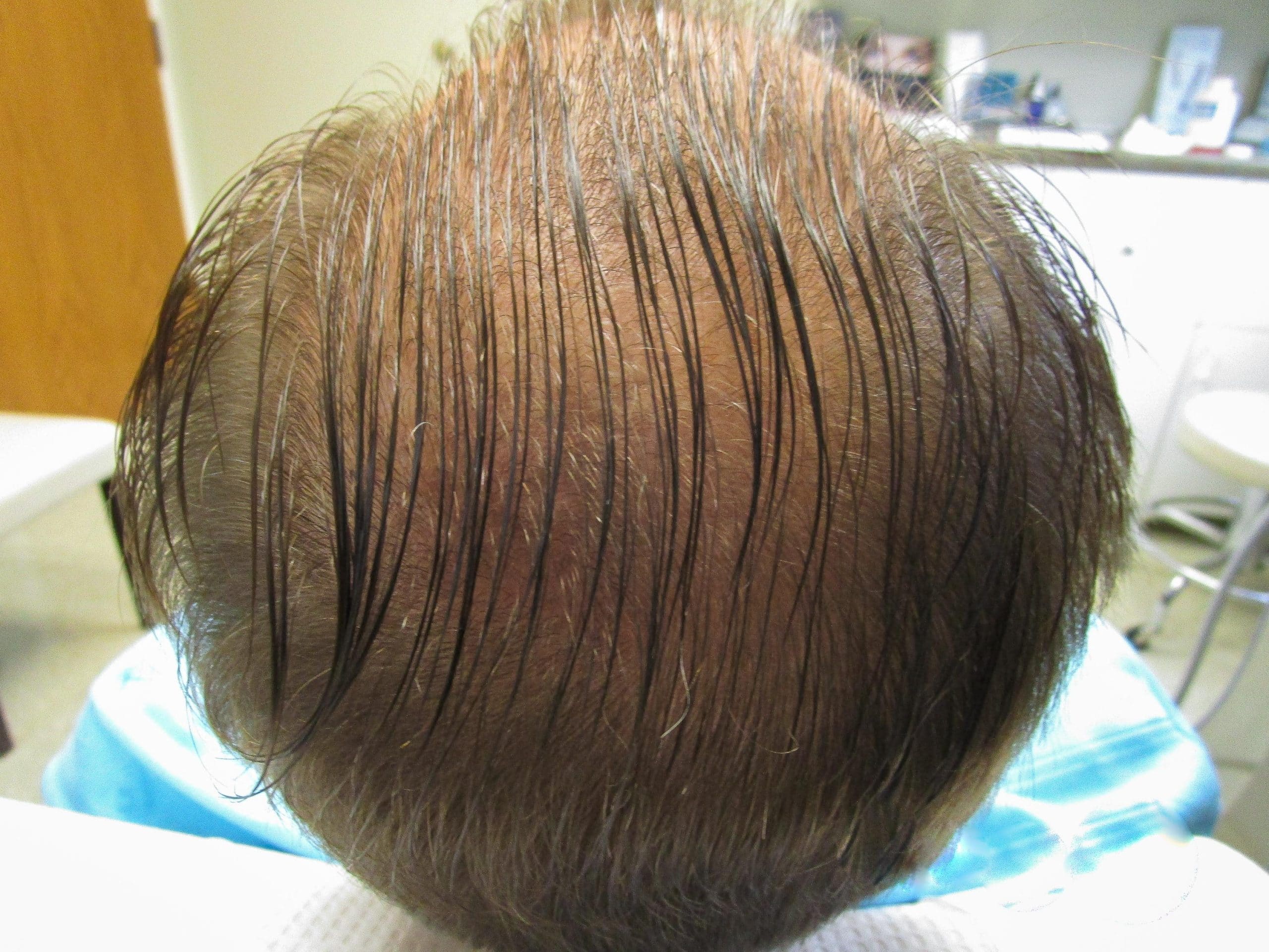 Guy After