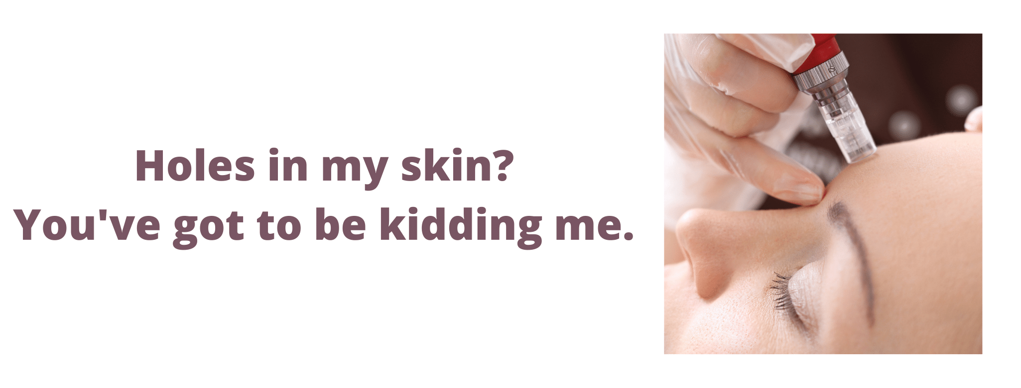 microneedling